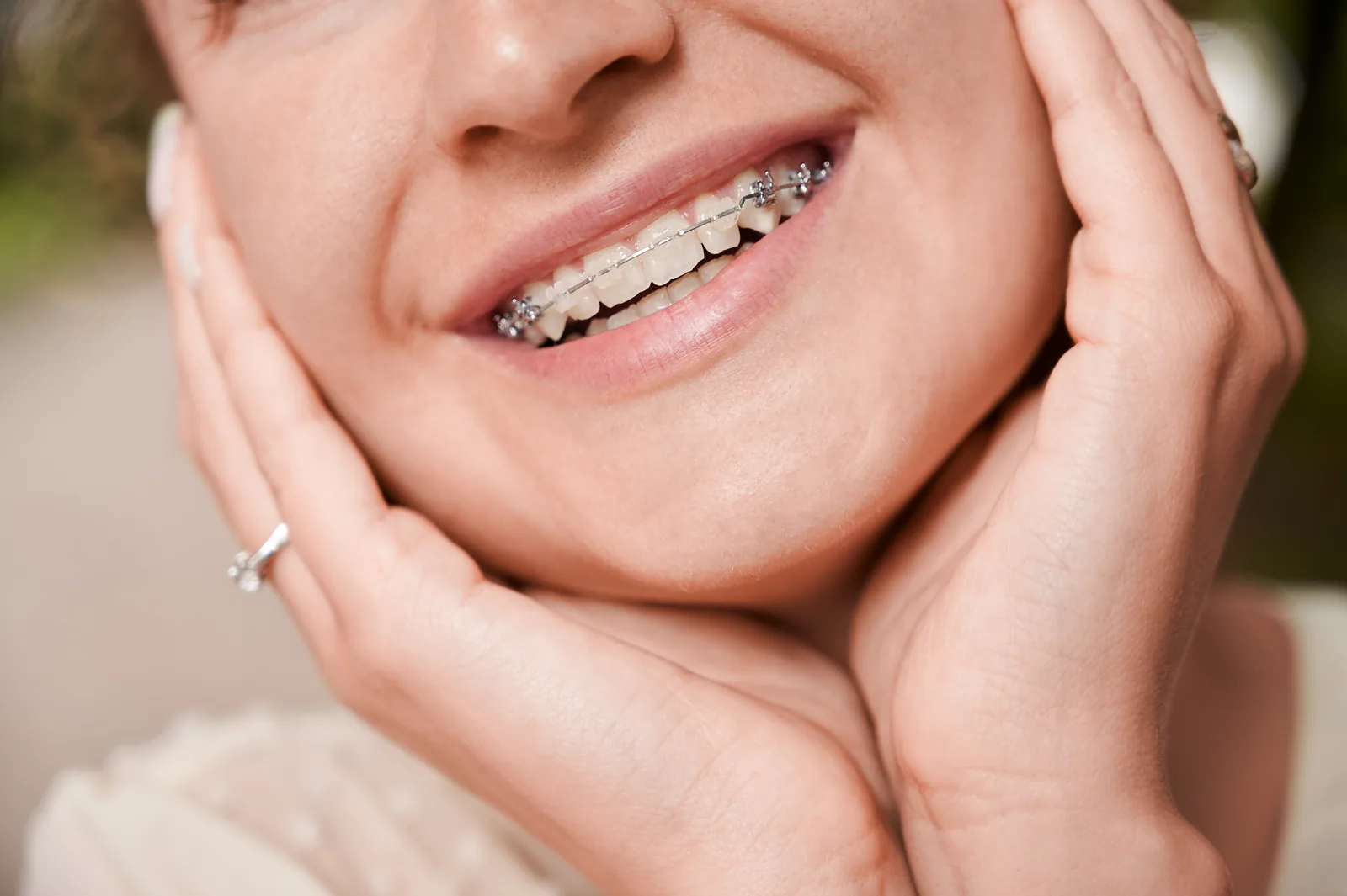 Adult orthodontic patient at Sytek Ortho in Alpena, MI