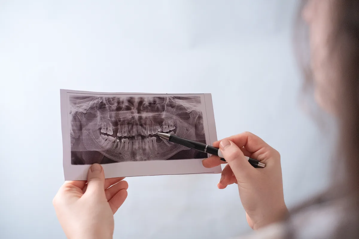 Jaw surgery consultation at Sytek Ortho in Alpena, MI