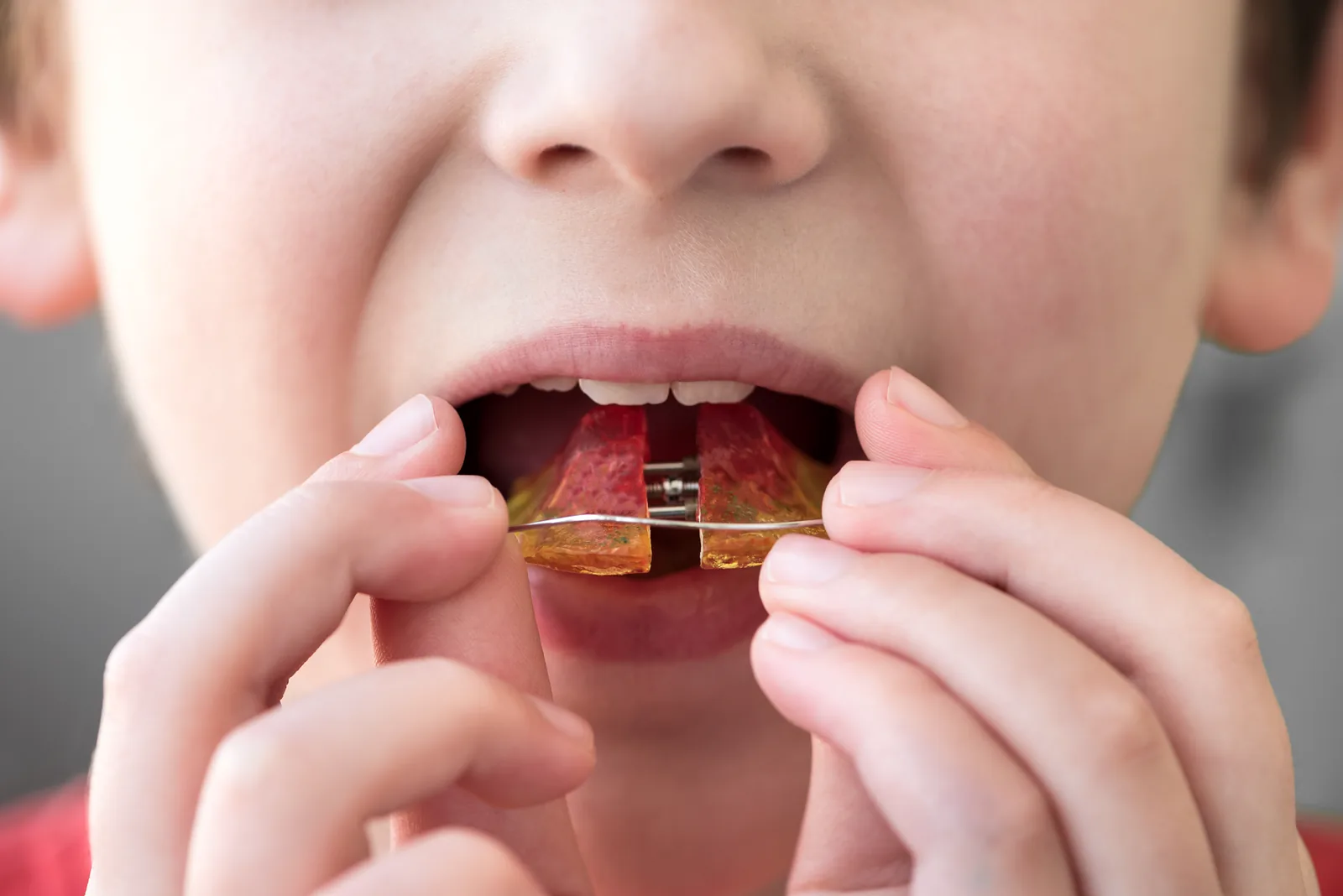 Young patient at a first orthodontic evaluation at Sytek Ortho in Alpena, MI